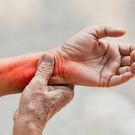 Rheumatology